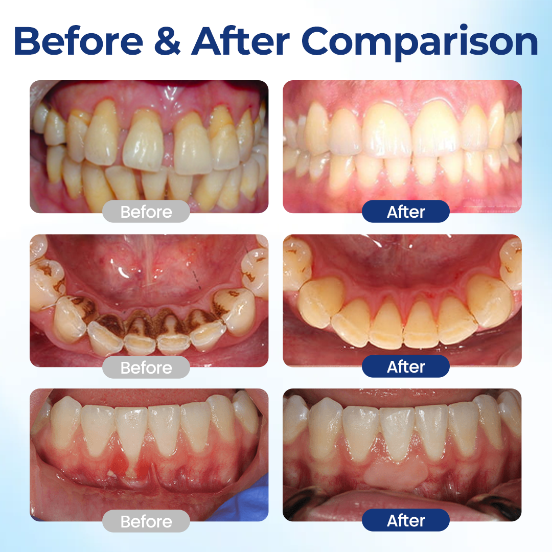 Healthier gums and fresher breath in 14 days or less