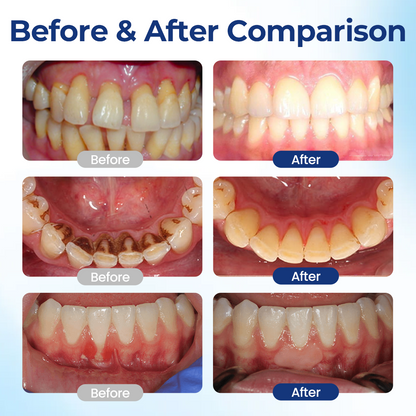 Healthier gums and fresher breath in 14 days or less