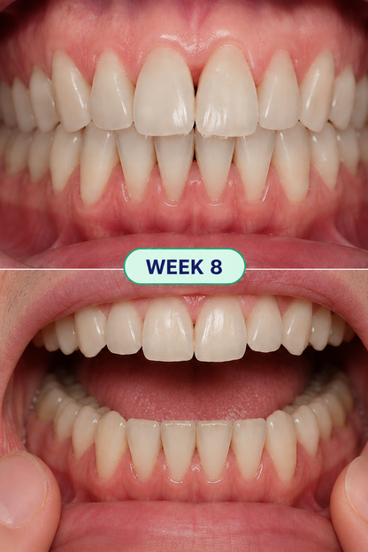 Healthier gums and fresher breath in 14 days or less